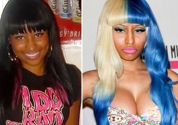 Nicki Minaj before and after plastic surgery