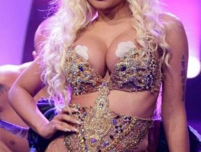 Nicki Minaj plastic surgery (1)