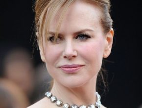Nicole Kidman plastic surgery (12)