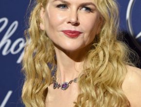 Nicole Kidman plastic surgery (13)