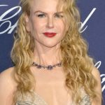 Nicole Kidman plastic surgery (19)