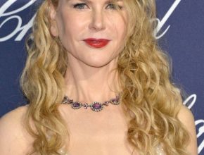 Nicole Kidman plastic surgery (19)