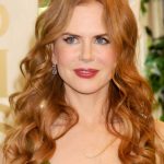 Nicole Kidman plastic surgery (23)