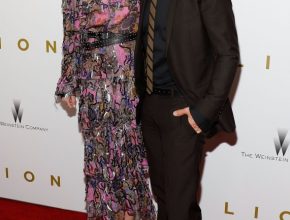 Nicole Kidman plastic surgery (25) with Keith Urban