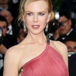 Nicole Kidman plastic surgery (30)
