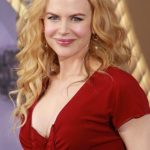 Nicole Kidman plastic surgery (6)