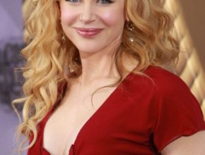 Nicole Kidman plastic surgery (6)