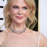 Nicole Kidman plastic surgery (7)