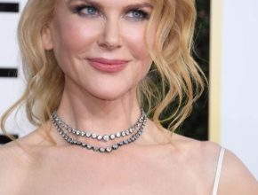 Nicole Kidman plastic surgery (7)
