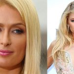Paris Hilton before and after plastic surgery (13)