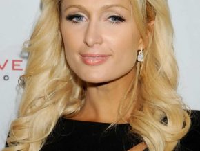 Paris Hilton plastic surgery (01)