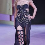 Paris Hilton plastic surgery (15)