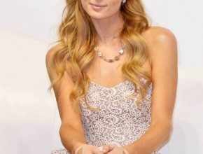 Paris Hilton plastic surgery (2)