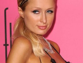 Paris Hilton plastic surgery (20)