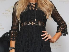 Paris Hilton plastic surgery (27)