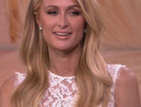 Paris Hilton plastic surgery (37)