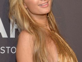 Paris Hilton plastic surgery (43)