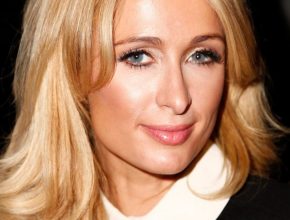 Paris Hilton plastic surgery (9)