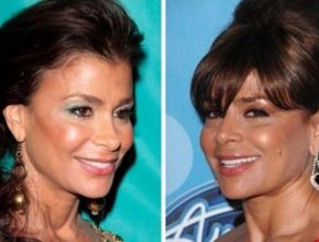Paula Abdul before and after plastic surgery