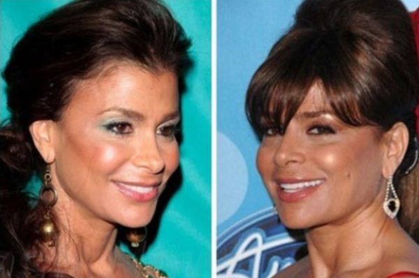 Paula Abdul before and after plastic surgery