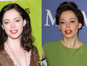 Rose McGowan before and after plastic surgery