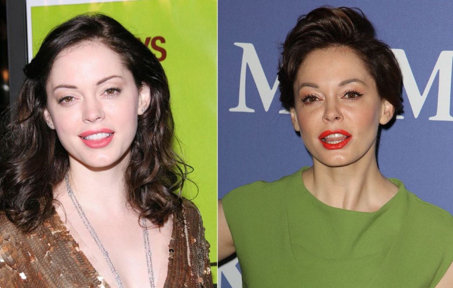Rose McGowan before and after plastic surgery