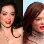 Rose McGowan before and after plastic surgery (1)