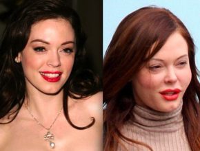 Rose McGowan before and after plastic surgery (1)