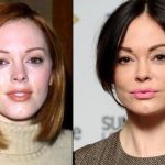 Rose McGowan before and after plastic surgery (10)
