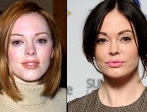 Rose McGowan before and after plastic surgery (10)