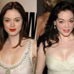 Rose McGowan before and after plastic surgery (11)