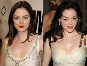 Rose McGowan before and after plastic surgery (11)