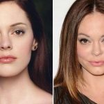 Rose McGowan before and after plastic surgery (12)