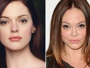 Rose McGowan before and after plastic surgery (12)