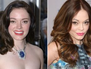 Rose McGowan before and after plastic surgery