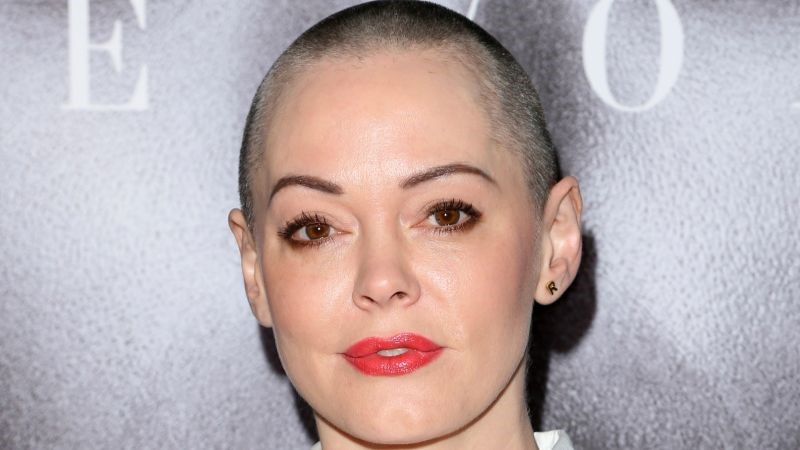 Rose McGowan plastic surgery