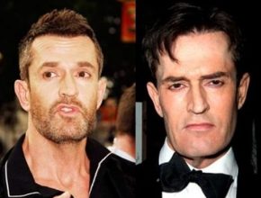 Rupert Everett before and after plastic surgery (10)