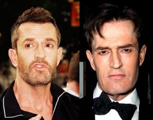 Rupert Everett before and after plastic surgery (10) .