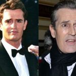 Rupert Everett before and after plastic surgery (11)