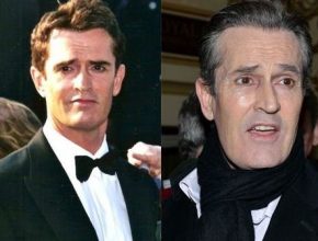 Rupert Everett before and after plastic surgery (11)