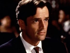 Rupert Everett plastic surgery (16)