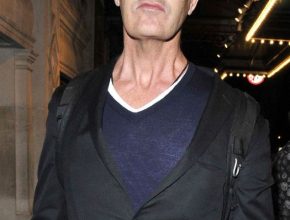 Rupert Everett plastic surgery (18)