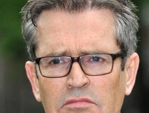 Rupert Everett plastic surgery