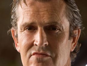 Rupert Everett plastic surgery (4)