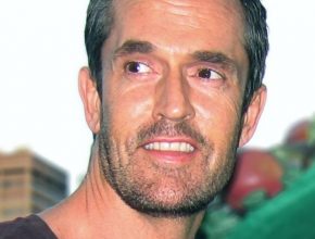 Rupert Everett plastic surgery (40)