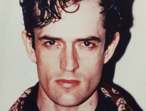 Rupert Everett plastic surgery (41)