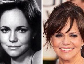 Sally Field before and after plastic surgery