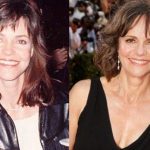 Sally Field before and after plastic surgery (6)