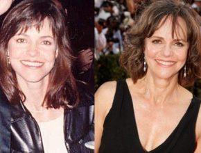 Sally Field before and after plastic surgery (6)