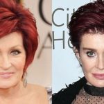 Sharon Osbourne before and after plastic surgery (1)